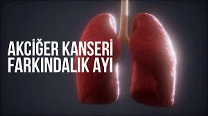 AKCİĞER KANSERİ FARKINDALIK AYI